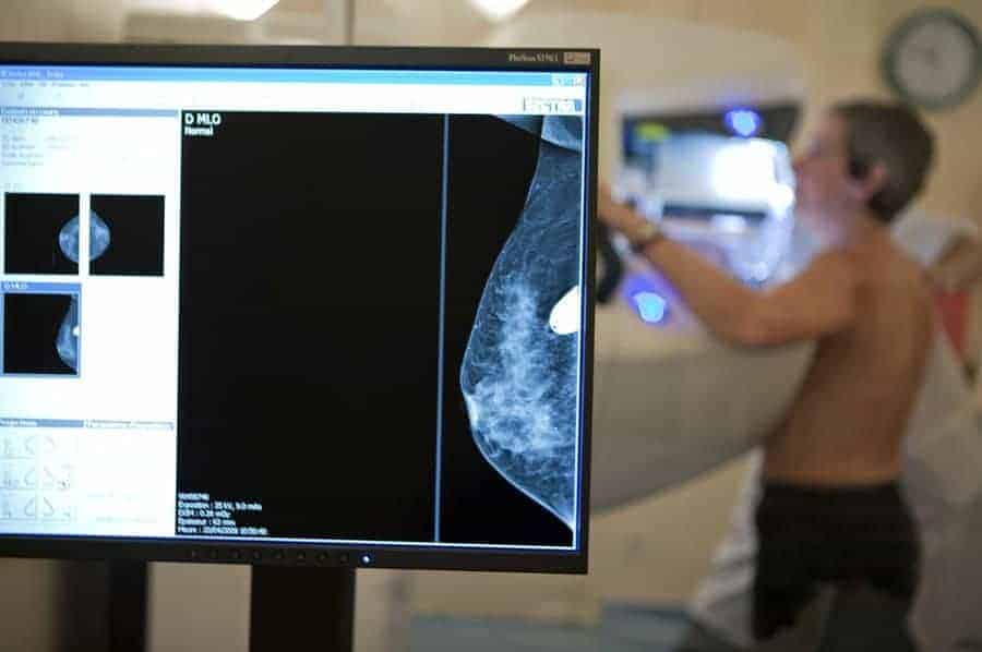 Dangers of Mammograms