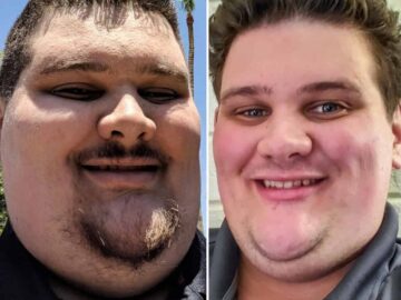 Brandin Lost Over 100 lbs Before and After