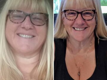 Lori G. Reversed Diabetes Before and After