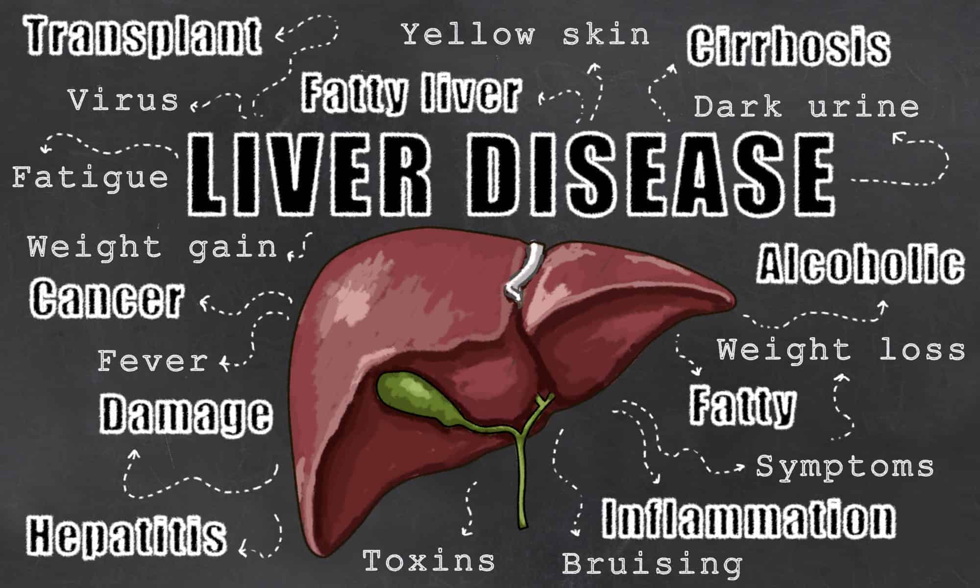 What Is Fatty Liver Disease Called